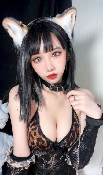 深圳猴痘:92例感染性传播风险高